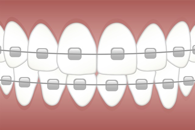 歯科矯正イメージ